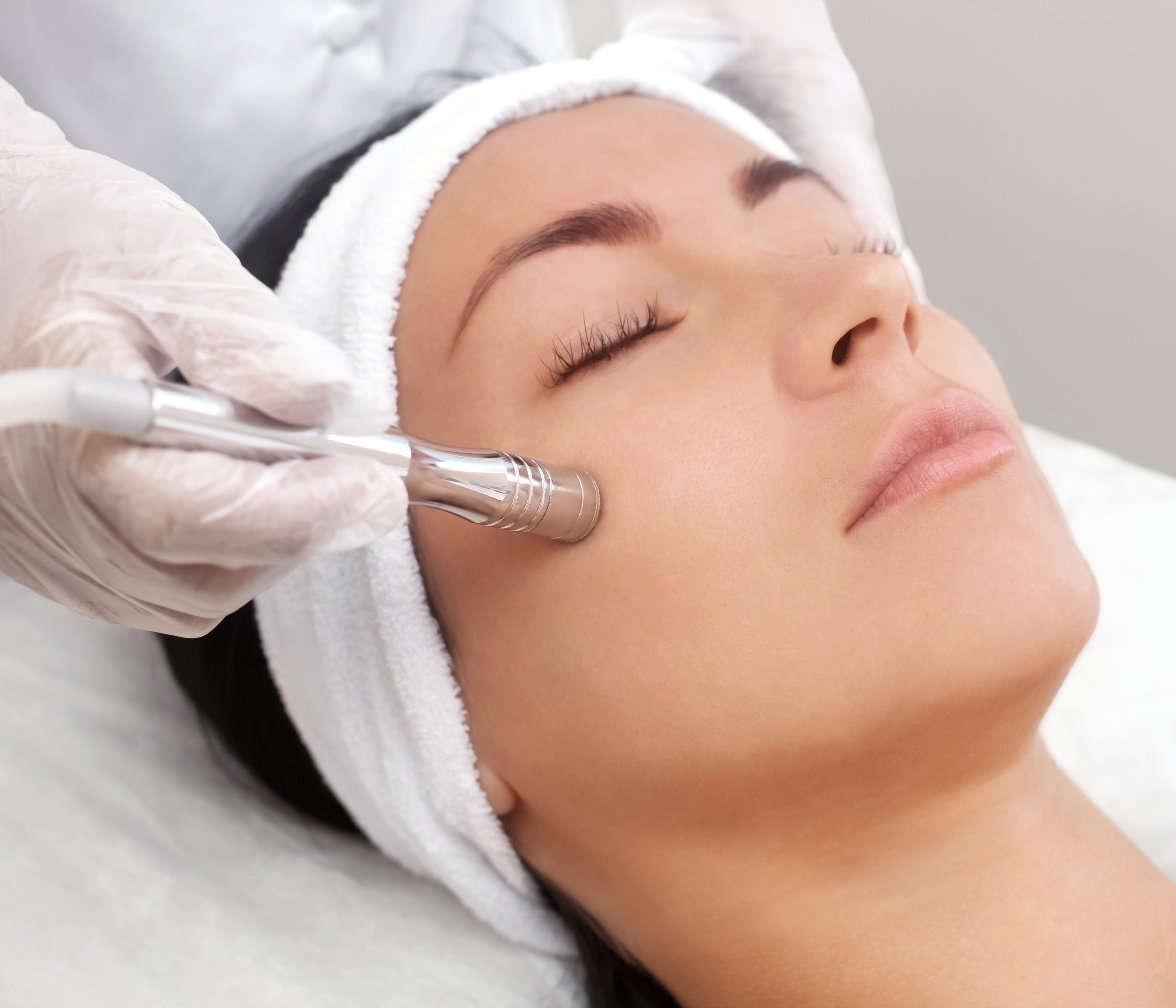 Microdermabrasion